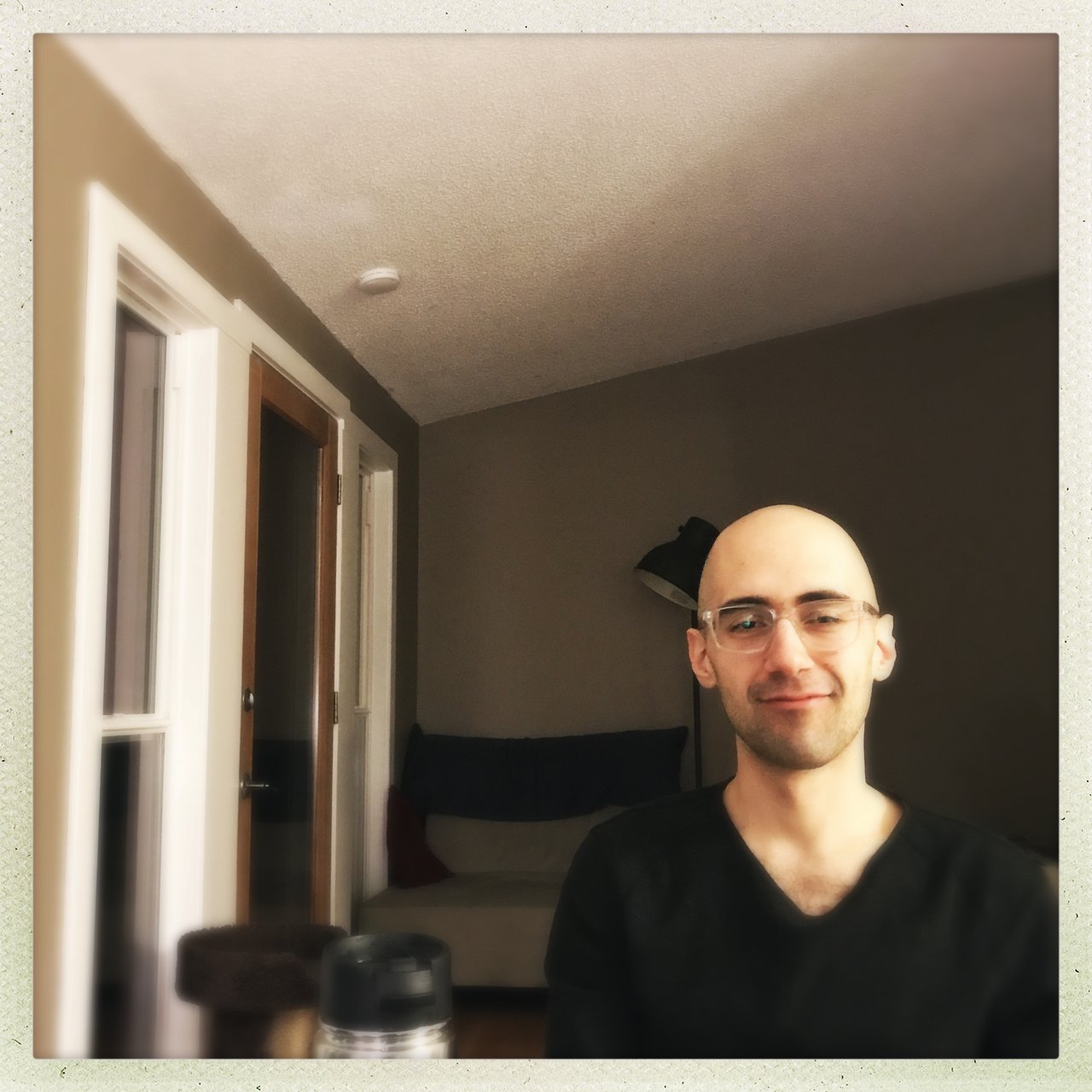 Where did all my hair go?!